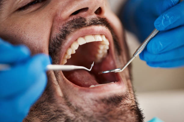 Best Emergency Dental Care for Broken or Chipped Teeth in Williams, AZ