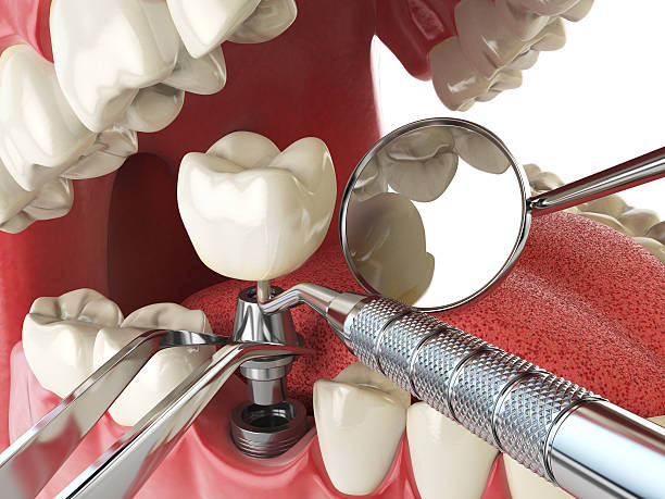 Best Emergency Treatment for Dental Infections or Abscesses in Williams, AZ